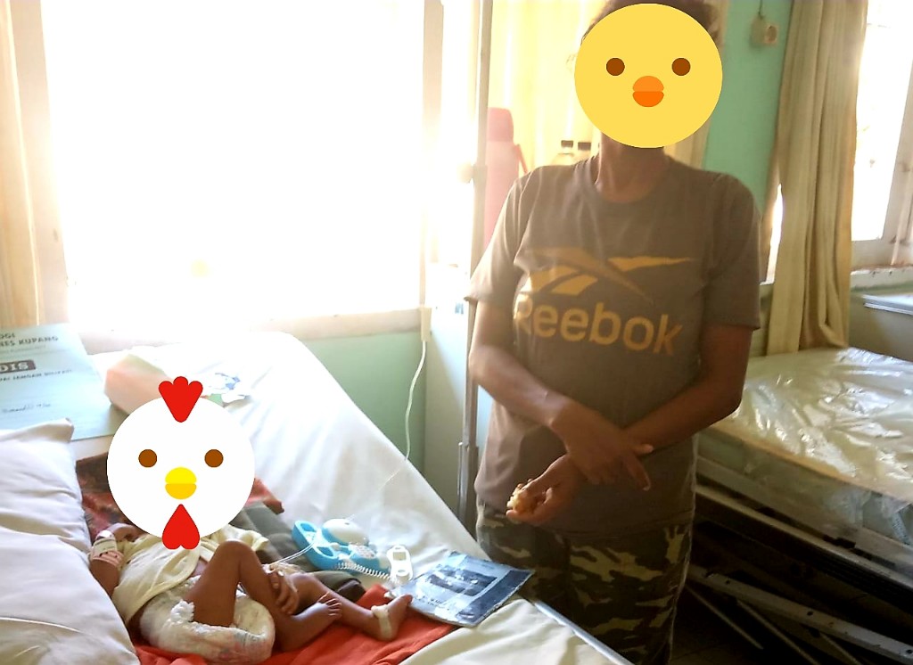 Di Kupang, Ayah Aniaya Balita Hingga Patah Tulang & Disulut Api Rokok