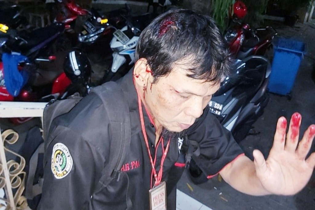 Wartawan Sinar Pagi Dianiaya Aparat, STOP Tindak Kekerasan!